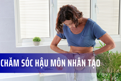 Chăm sóc hậu môn nhân tạo