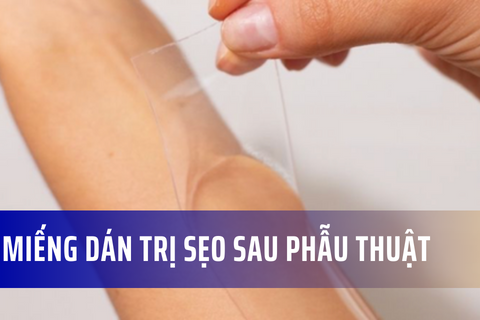 Miếng dán silicone xóa mờ sẹo sau phẫu thuật