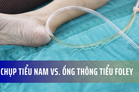 Phân biệt bộ chụp tiểu nam và ống thông tiểu foley