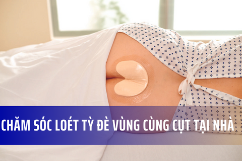 Cách chăm sóc vết loét vùng cùng cụt tại nhà