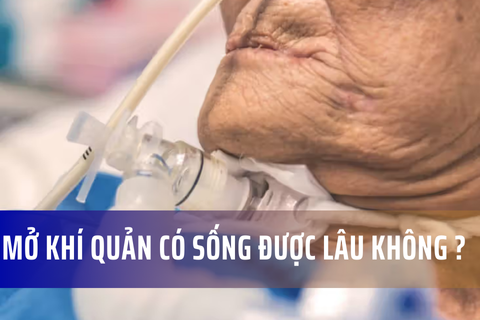 Phẫu thuật mở khí quản ảnh hưởng đến tuổi thọ không?