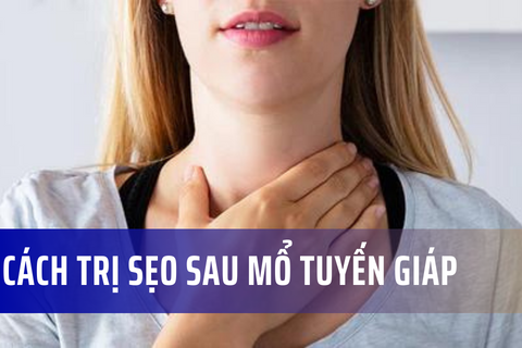 Cách trị sẹo sau mổ tuyến giáp