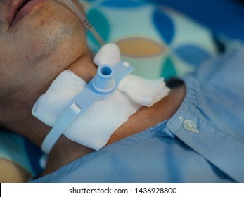 Chăm sóc mở khí quản và chăm sóc người bệnh có mở khí quản 
