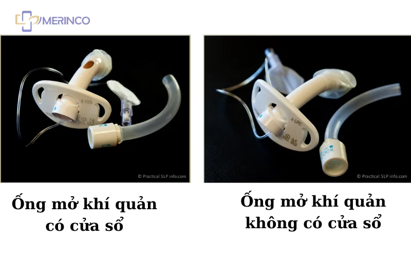 Mở khí quản có cửa sổ