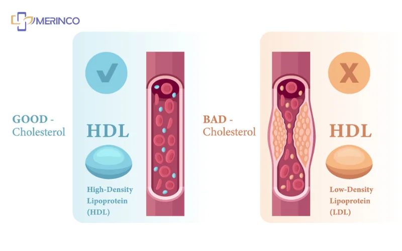 Cholesterol tốt và xấu