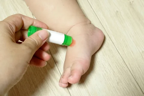 6 phương pháp giúp vết thương nhanh lành hơn - dầu dừa