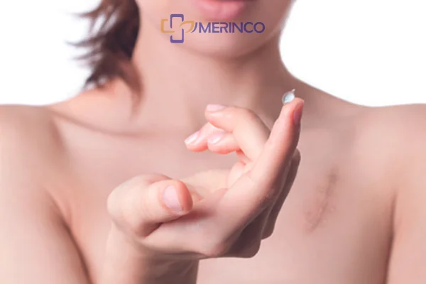 Gel silicone chữa lành sẹo như thế nào?