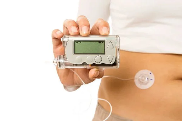 Máy bơm tiêm insulin tự động: Tiện và không tiện