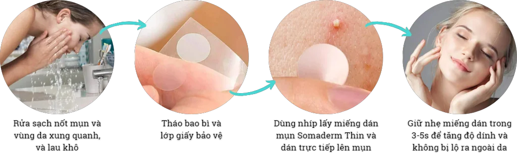 Miếng dán mụn mỏng Somaderm-Thin ngăn sẹo, giảm thâm (12 miếng)