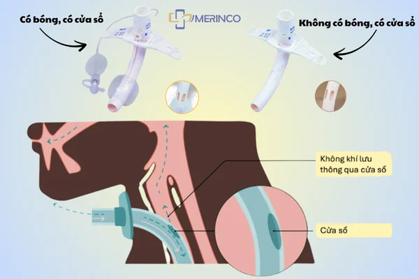 Ống mở khí quản có cửa sổ