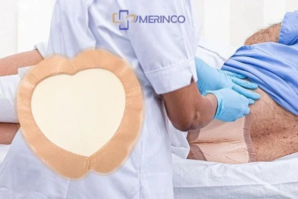 Tìm hiểu các loại loét da