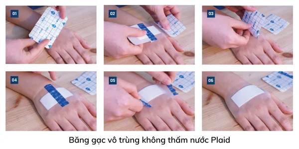 Băng gạc vô trùng không thấm nước Plaid - Trị bỏng tại nhà an toàn