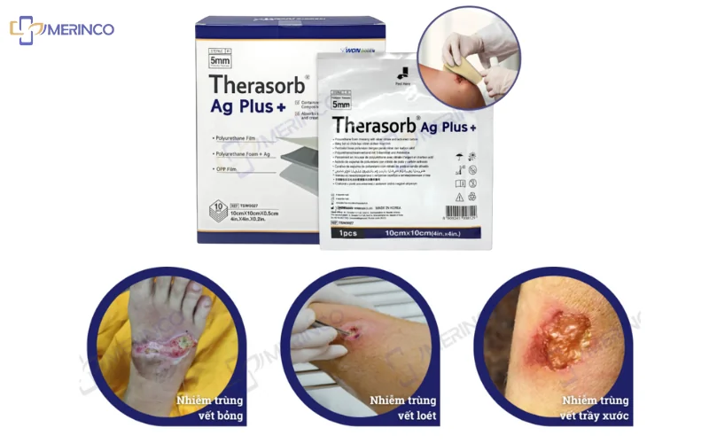 băng gạc xốp Therasorb