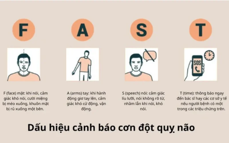 Dấu hiệu Đột quỵ