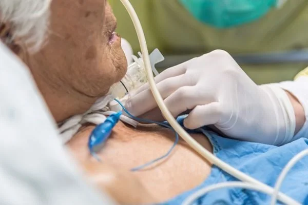 Bệnh nhân mở khí quản cần được theo dõi sát sao để tránh các biến chứng gây nhiễm trùng tại chỗ, viêm phổi hoặc các nguy cơ tắc hoặc tuột ống gây nguy hiểm tính mạng.