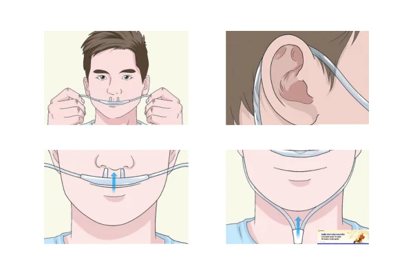 Hướng dẫn cách đeo dây thở oxy
