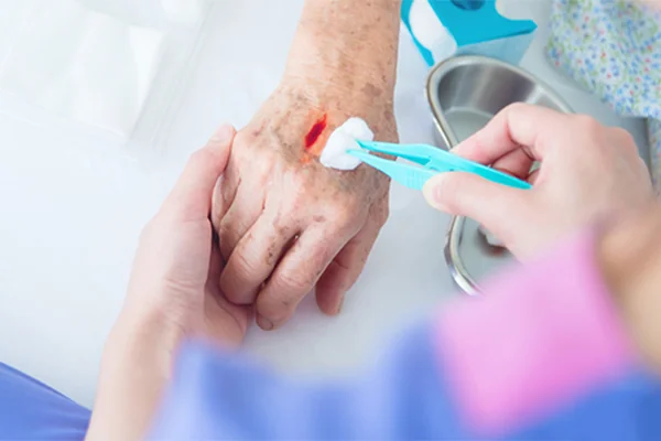 Làm sạch vết thương đúng cách