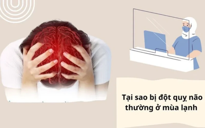 Đột quỵ não