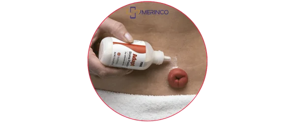 Phụ kiện Hậu môn nhân tạo: Thời điểm và Cách sử dụng