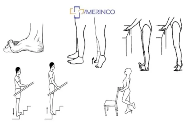Suy giãn tĩnh mạch mạn tính có được tập thể dục không?