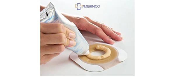 Phụ kiện Hậu môn nhân tạo: Thời điểm và Cách sử dụng