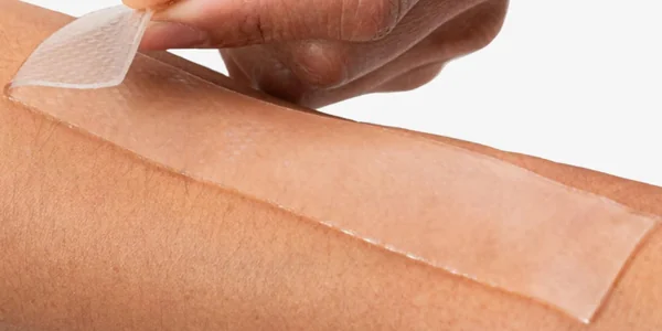 Vết sẹo bị ngứa tại sao? Cách trị sẹo ngứa hiệu quả