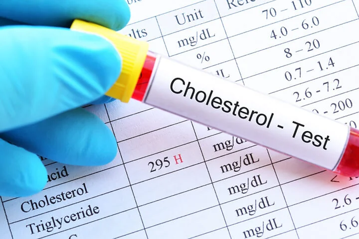 Ai có nguy cơ mắc cholesterol cao?- Ảnh 2. Ai có nguy cơ mắc cholesterol cao?- Ảnh 2.