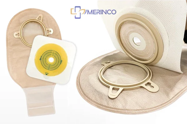 Hậu môn nhân tạo đại tràng là gì?