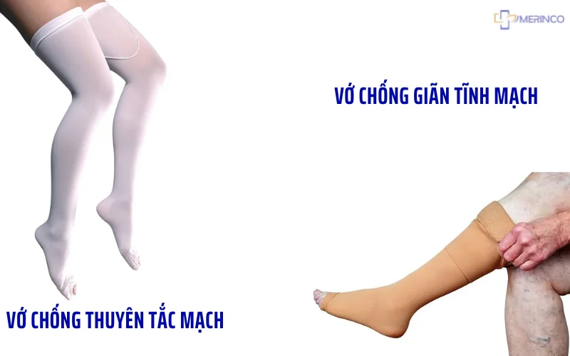 vớ chống giãn tĩnh mạch