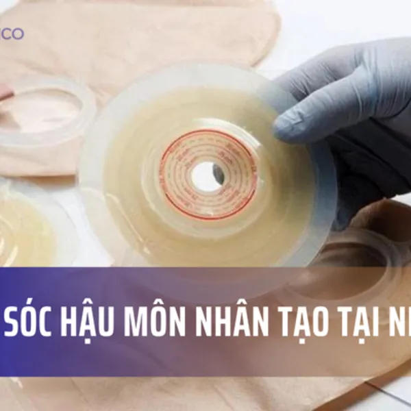Chăm Sóc Hậu Môn Nhân Tạo: Hướng Dẫn Cho Người Bệnh Và Người Chăm Sóc