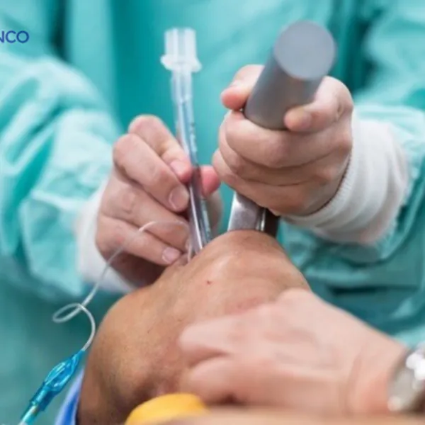 Nghiên cứu về Biến Chứng và Yếu Tố Liên Quan Sau Đặt Nội Khí Quản Cấp Cứu