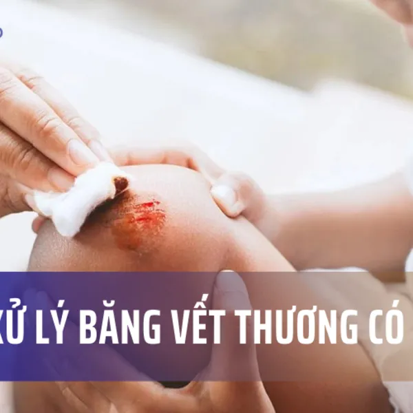 Cách xử lý băng vết thương có mùi