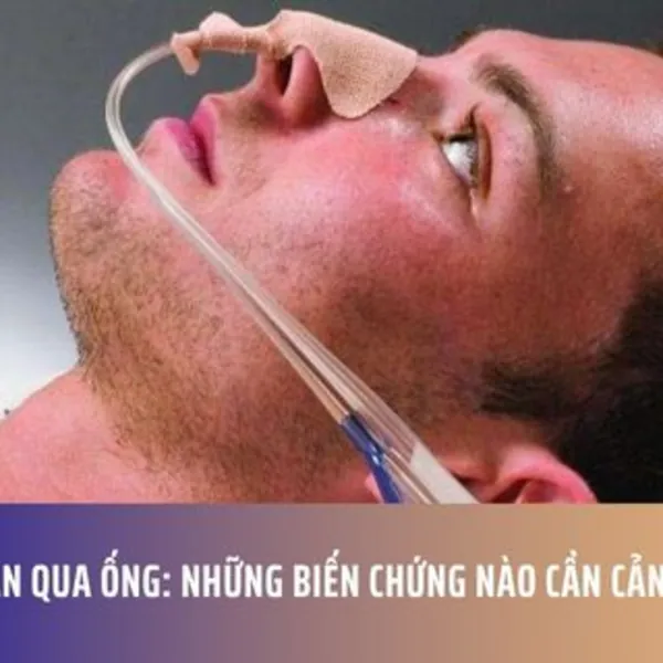 Nuôi Ăn Qua Ống: Những Biến Chứng Nào Cần Cảnh Giác?