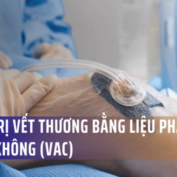 Điều trị vết thương bằng Liệu pháp chân không (VAC)