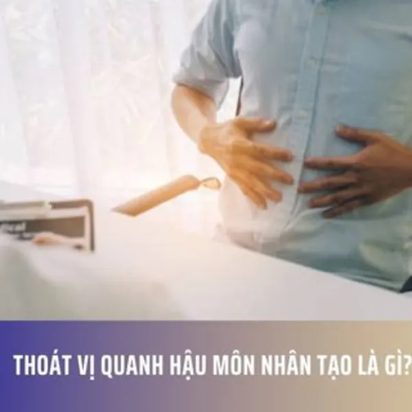 Thoát vị quanh hậu môn nhân tạo là gì?