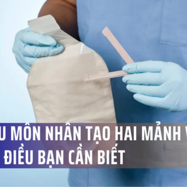 Mọi thứ bạn cần biết về hệ thống túi hậu môn nhân tạo hai mảnh
