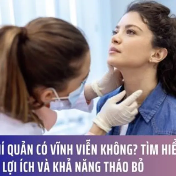 Mở khí quản có vĩnh viễn không? Tìm hiểu chức năng, lợi ích và khả năng tháo bỏ