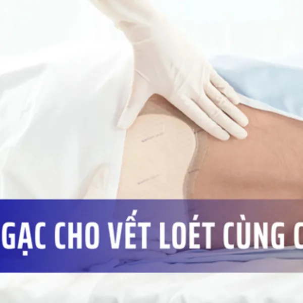 Băng gạc cho vết loét vùng cùng cụt
