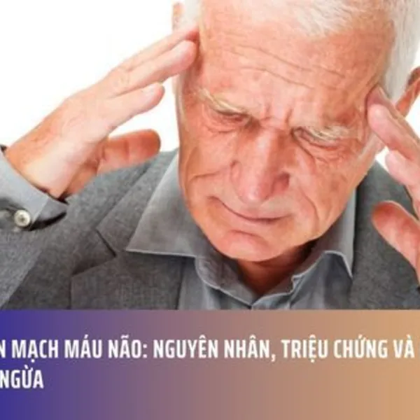 Tai Biến Mạch Máu Não: Nguyên Nhân, Triệu Chứng Và Giải Pháp Phòng Ngừa