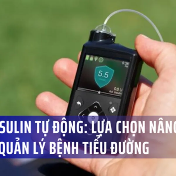 Liệu pháp bơm insulin tự động: Một lựa chọn nâng cao trong quản lý bệnh tiểu đường