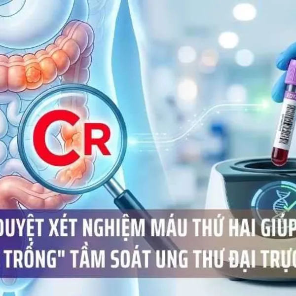 FDA Phê Duyệt Xét Nghiệm Máu Thứ Hai Giúp Thu Hẹp "Khoảng Trống" Tầm Soát Ung Thư Đại Trực Tràng