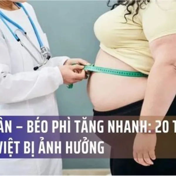 Thừa Cân – Béo Phì Tăng Nhanh: 20 Triệu Người Việt Bị Ảnh Hưởng