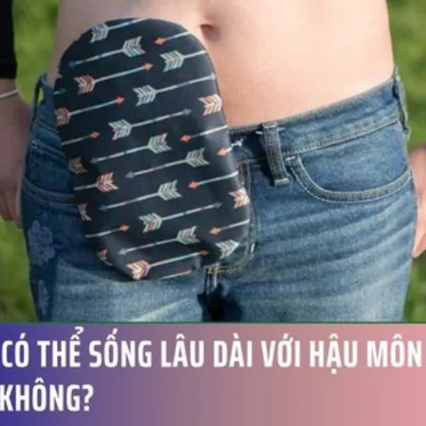 Bạn có thể sống lâu dài với hậu môn nhân tạo không?
