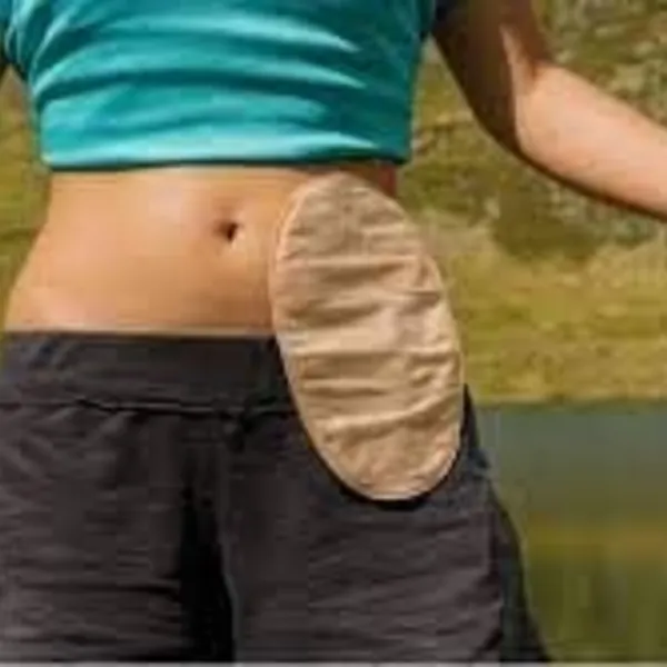 Những thực phẩm nên ăn và không nên ăn khi sống chung với hậu môn nhân tạo