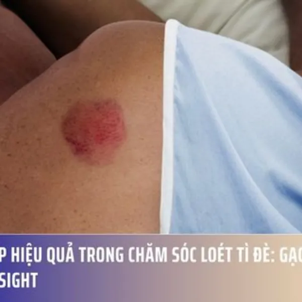 Giải Pháp Hiệu Quả Trong Chăm Sóc Loét Tì Đè: Gạc Xốp Hút Dịch Seasight