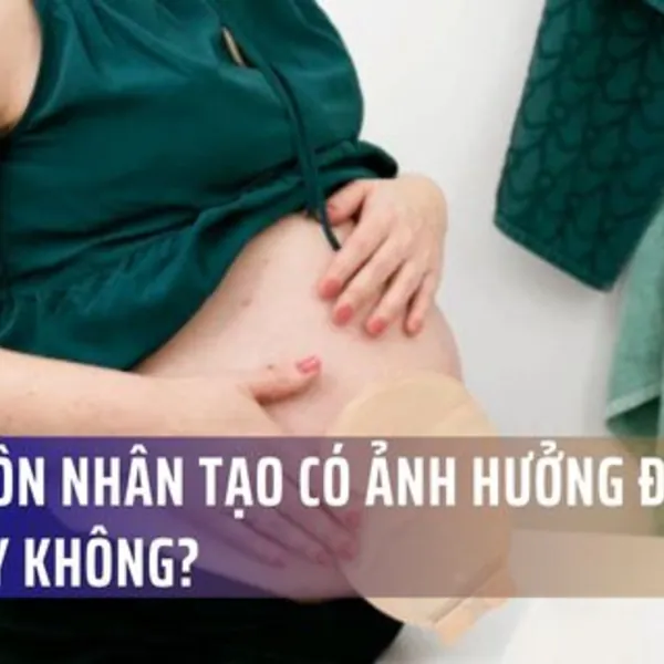 Hậu môn nhân tạo ảnh hưởng đến thai kỳ không?