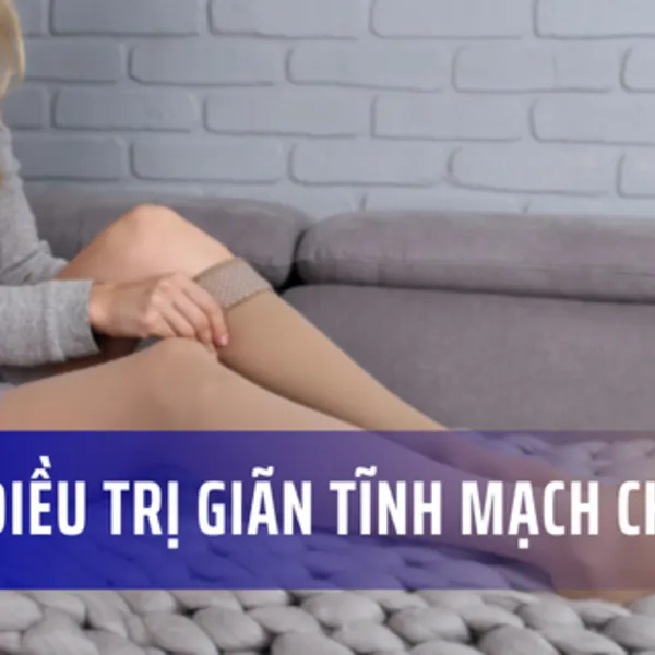 Các phương pháp điều trị giãn tĩnh mạch chân