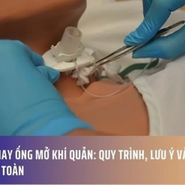 Cách Thay Ống Mở Khí Quản: Quy Trình, Lưu Ý và Hướng Dẫn An Toàn