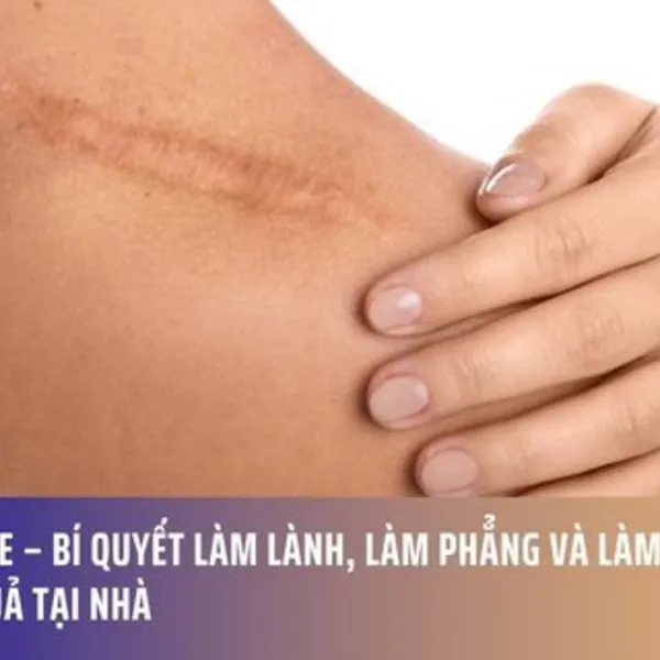 Silicone – Bí quyết làm lành, làm phẳng và làm mờ sẹo hiệu quả tại nhà