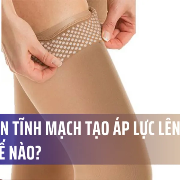 Tất giãn tĩnh mạch tạo áp lực lên chân như thế nào?